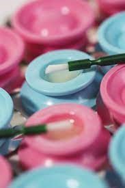 Managing Dentine Hypersensitivity with MI Varnish